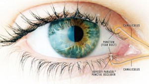 Dell Laser Consultants